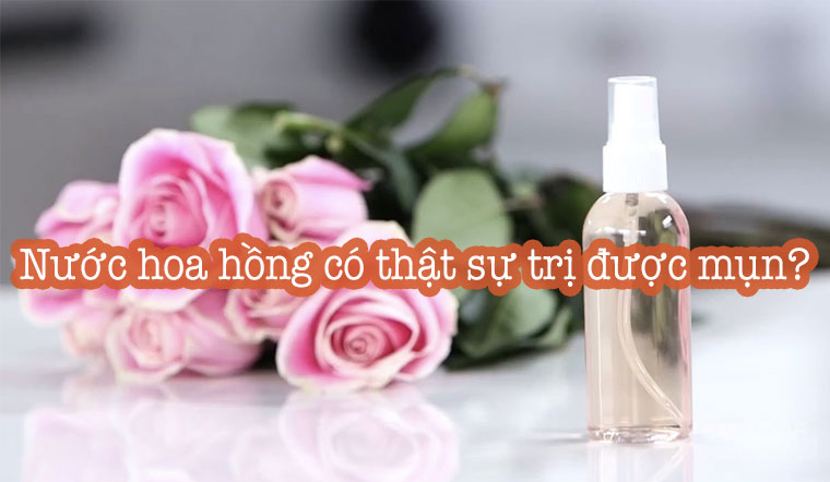 Nước hoa hồng có thật sự trị được mụn?