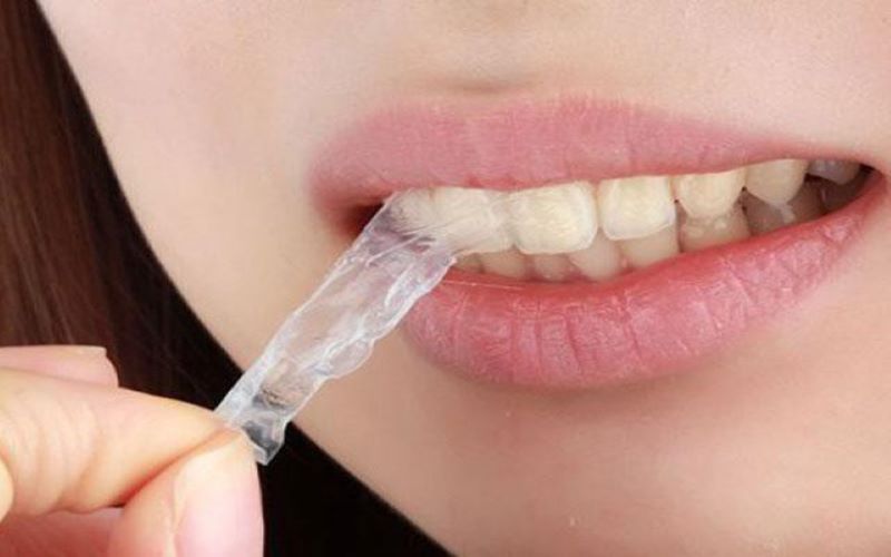 Có nên sử dụng miếng dán răng để làm trắng không?