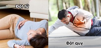 Phân biệt điểm khác nhau giữa đột quỵ và đột tử
