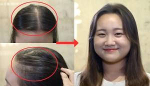 Stylist Hàn mách chị em cách 'cứu' mái tóc mỏng dính như bị hói tại nhà