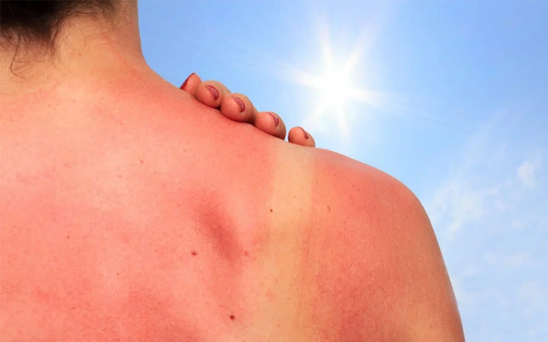 Ăn sung làm tăng độ nhảy cảm của cơ thể dưới nắng mặt trời, dễ mắc các bệnh về da 