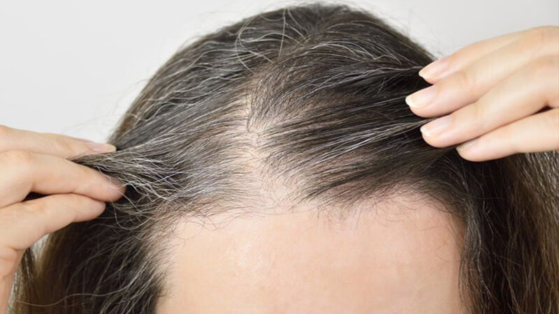 Nguyên nhân gây bạc tóc sớm ở nam giới