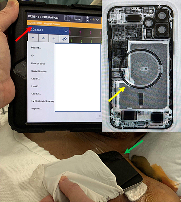 Nguyên nhân gây ra vấn đề này được cho là đến từ nam châm bên trong Magsafe
