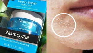 Top 9 kem dưỡng ẩm dành cho da khô tốt nhất hiện nay
