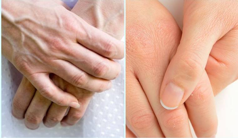 3 mẹo làm da tay hết nhăn nheo gân guốc bằng nguyên liệu cực kỳ đơn giản mà chị em không thể bỏ qua