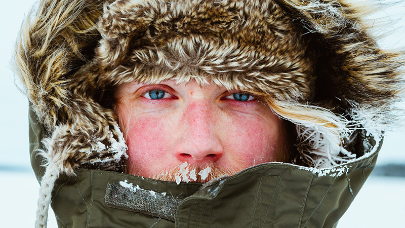 Dị ứng thời tiết lạnh – Nguyên nhân, triệu chứng và cách điều trị