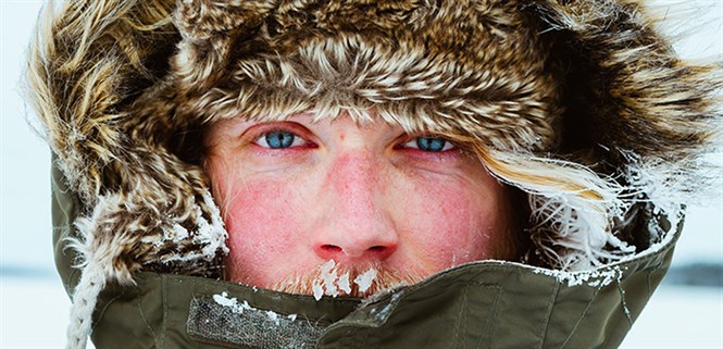 Dị ứng thời tiết lạnh là gì? Nguyên nhân, triệu chứng, cách phòng tránh và điều trị bạn nên biết