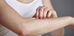 9 cách loại bỏ các tác nhân gây dị ứng ra khỏi không gian sống của bạn hiệu quả nhất