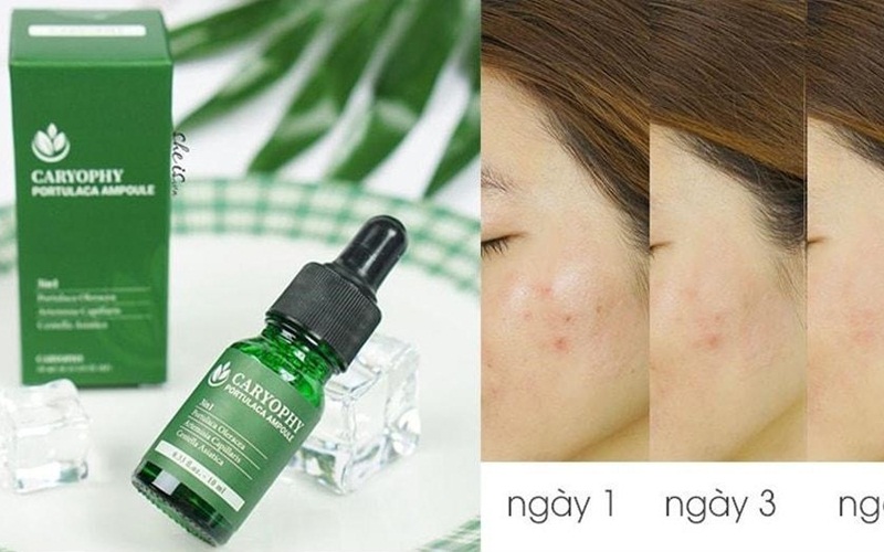 Sử dụng Serum Caryophy Portulaca Ampoule