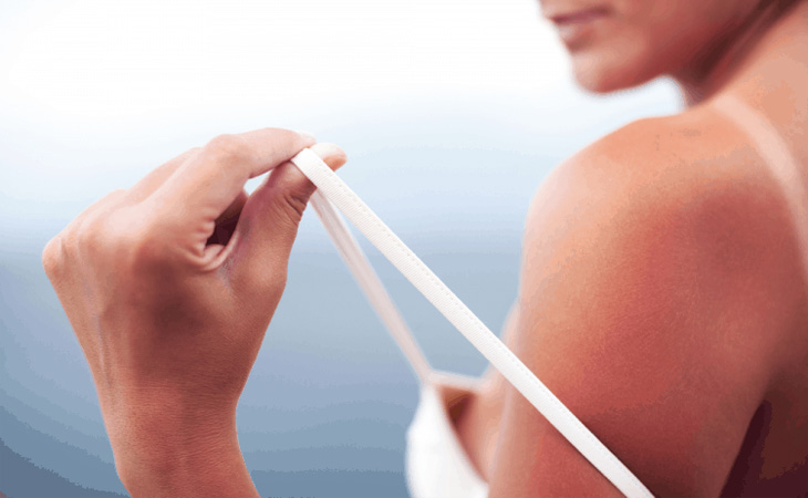 The link between UV rays and skin cancer