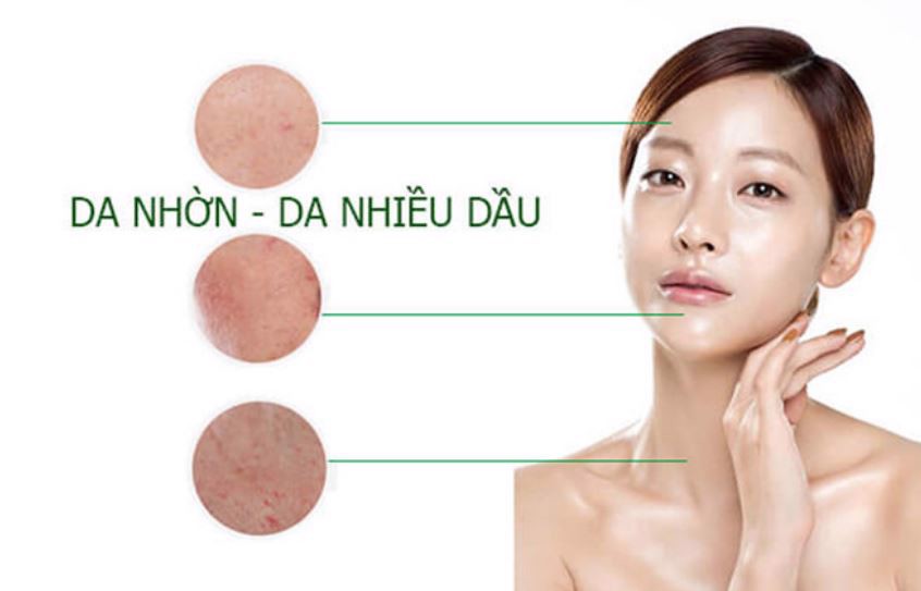 7 bí quyết thu nhỏ lỗ chân lông, hạn chế da nhờn vào mùa hè