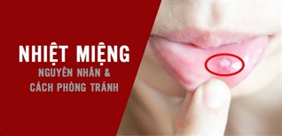 Nhiệt miệng, lở miệng vào mùa hè: Nguyên nhân và cách phòng tránh