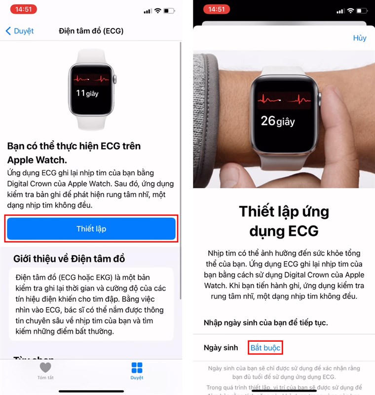 Cach-do-dien-tam-do-ECG-tren-Apple-Watch