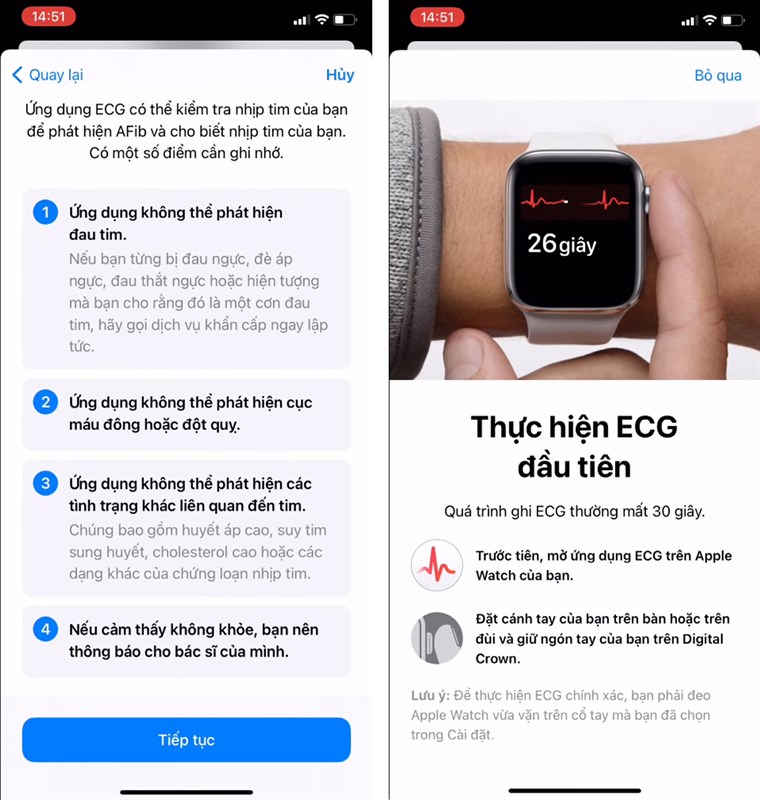 Cach-do-dien-tam-do-ECG-tren-Apple-Watch