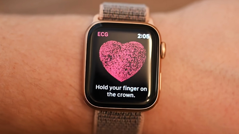 ECG Apple Watch