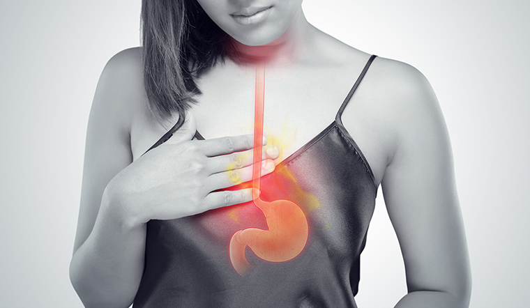Ợ chua là gì? Nguyên nhân, biểu hiện và cách xử lý khi bị ợ chua
