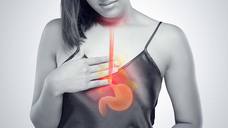 What is Ợ sour? Causes, symptoms and treatment of heartburn