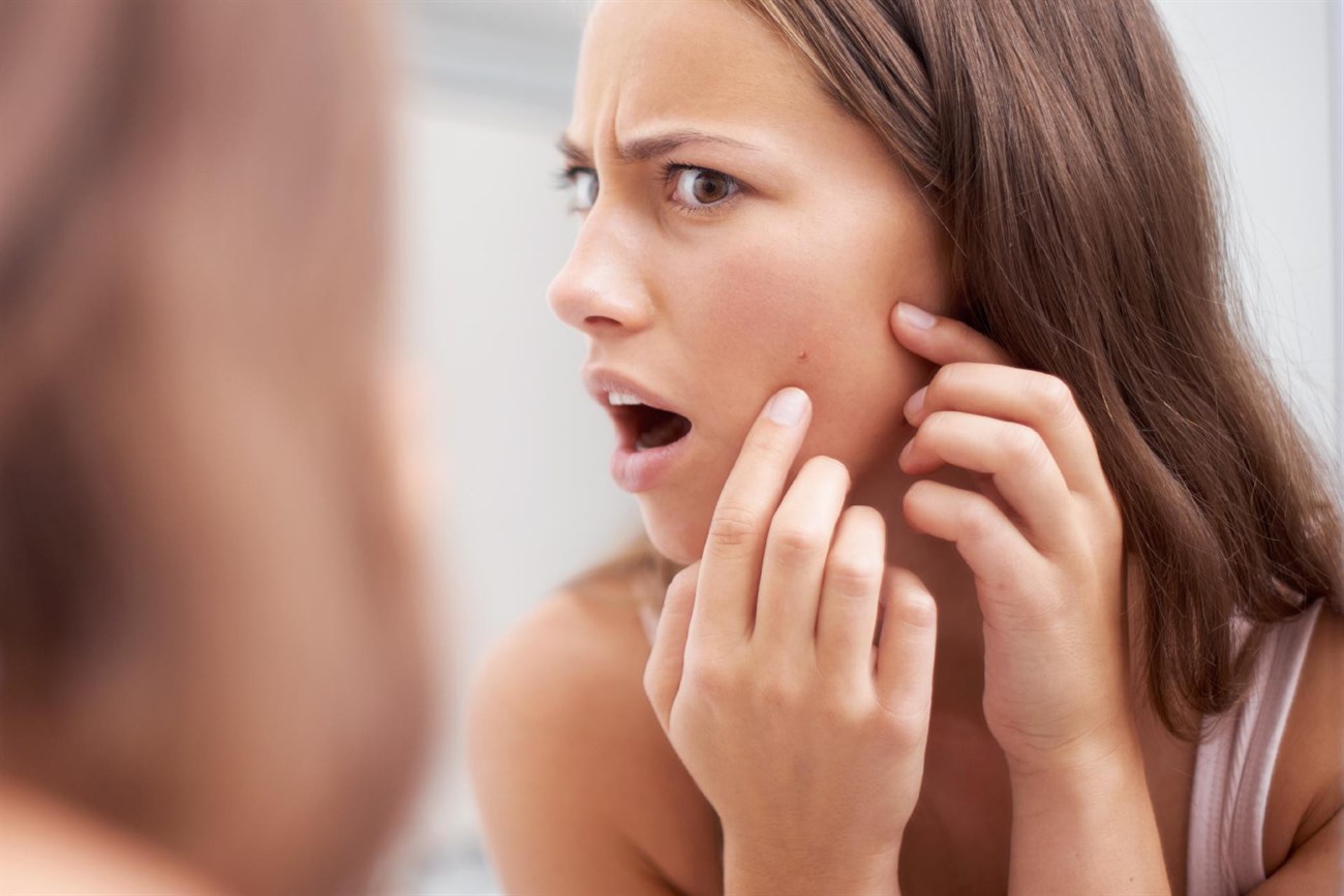 Limit touching your face, especially acne spots