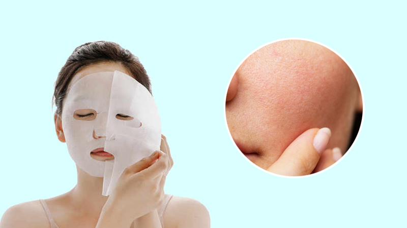 Đắp mặt nạ liên tục còn khiến cho da gặp các tổn thương