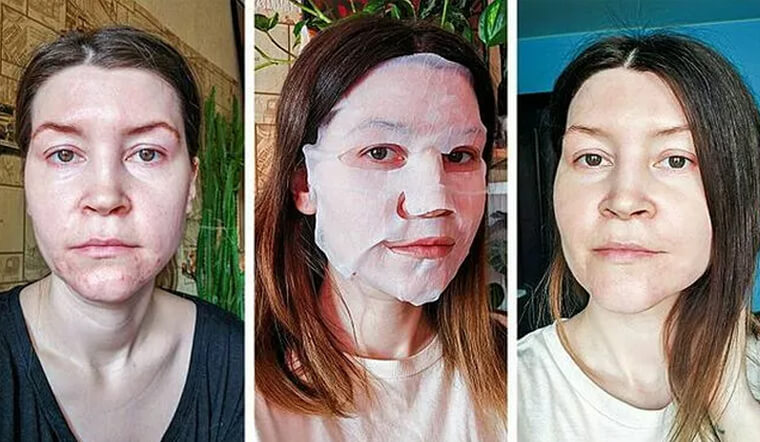 Mặc khuyến cáo của chuyên gia, cô gái đắp mặt nạ suốt 28 ngày có kết quả bất ngờ