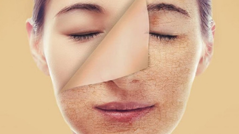 Retinol làm mỏng da Retinol làm mỏng da