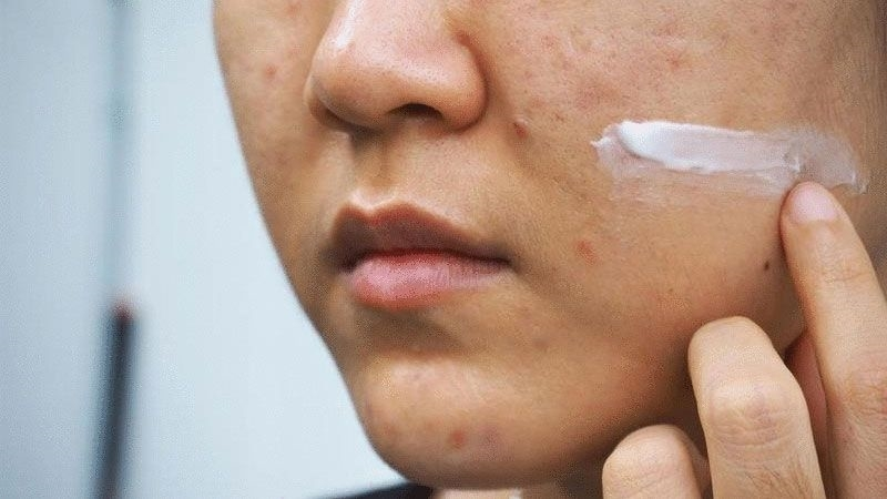 Dùng Retinol phải tắt đèn Dùng Retinol phải tắt đèn