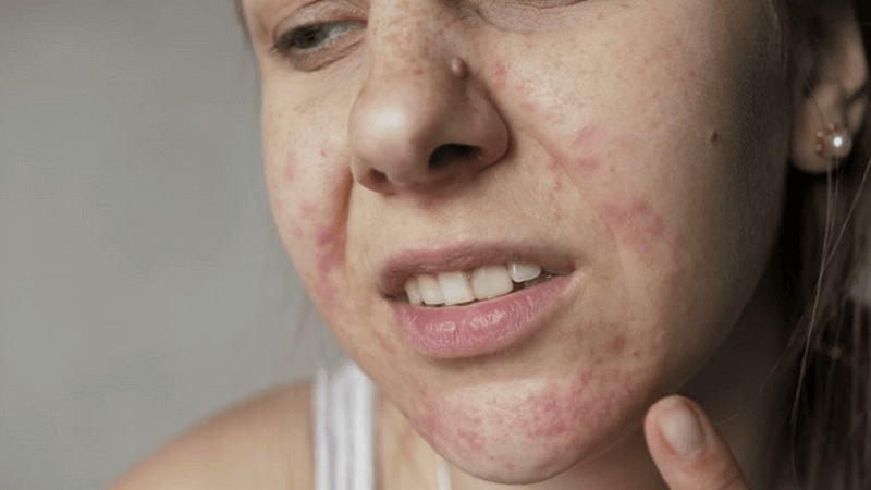 Không sử dụng Retinol cùng với AHA và BHA Không sử dụng Retinol cùng với AHA và BHA