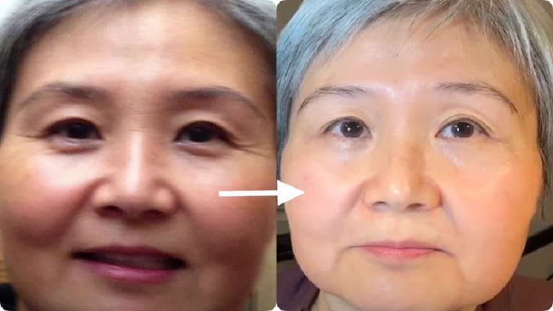 Retinol có an toàn khi sử dụng lâu dài không?