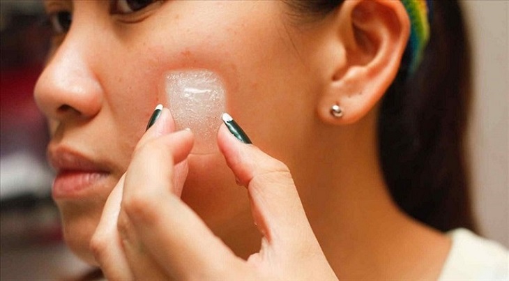 Applying ice on acne helps reduce pain and swelling