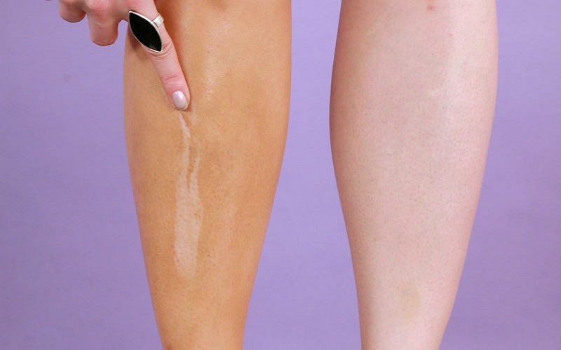 Kem nền che sẹo ở chân, phấn phủ phải cùng màu da mới hiệu quả