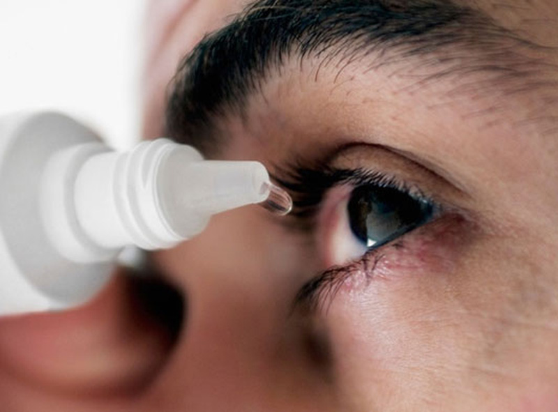 Bệnh đau mắt đỏ: Nguyên nhân, triệu chứng và cách phòng tránh