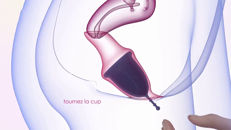 What is a menstrual cup? Can tampons be used instead?