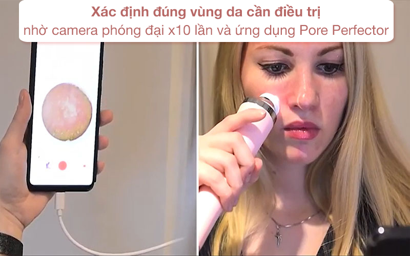 Máy hút mụn Rio điều trị mụn dễ dàng tại nhà qua ứng dụng Pore Perfector trên điện thoại