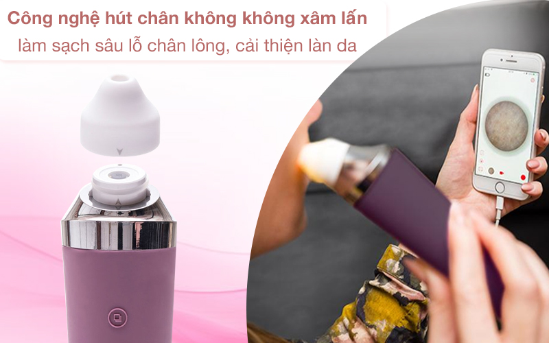 Máy hút mụn Rio Beauty loại bỏ mụn tối ưu nhờ công nghệ hút chân không không xâm lấn