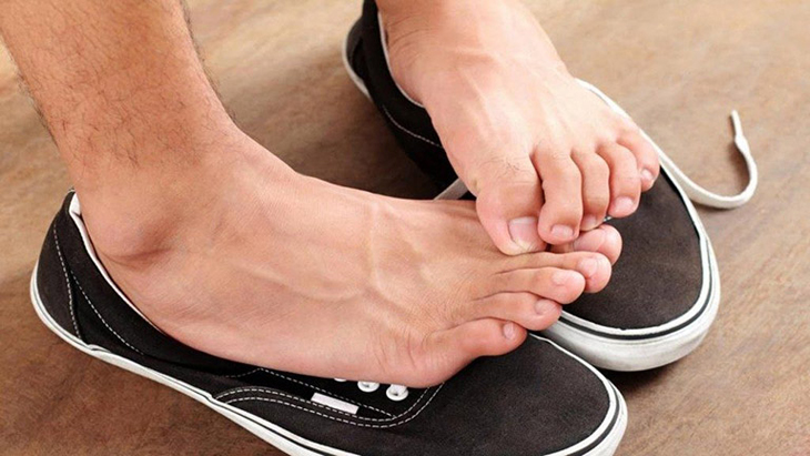 Nguyên nhân gây hôi chân do nhiễm trùng da ở bàn chân