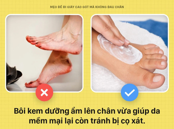 Moisturizing cream reduces foot pain in the toe and heel