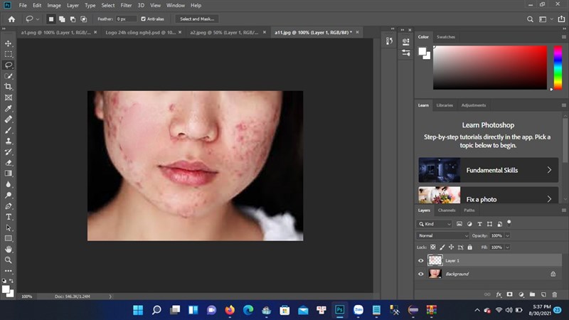 Cách xóa mụn bằng Photoshop