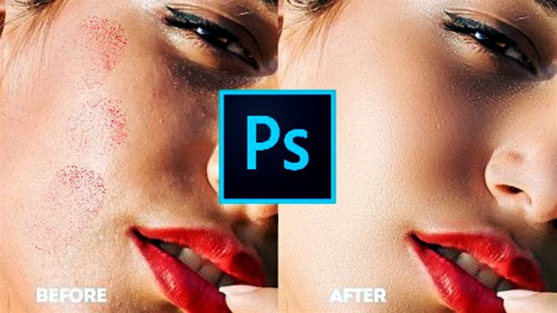 Cách xóa mụn bằng Photoshop