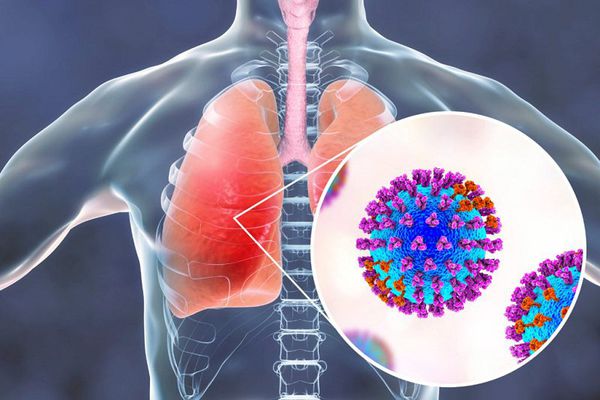 Hội chứng cơn bão cytokine xảy ra khi một tác nhân xâm nhập vào cơ thể