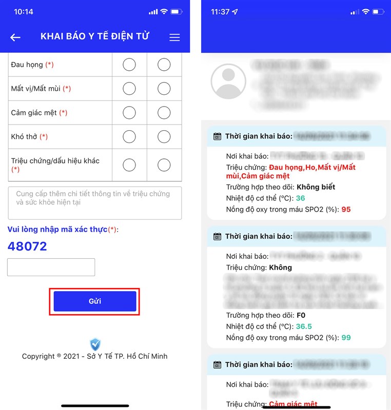 Cách tự theo dõi sức khỏe tại nhà