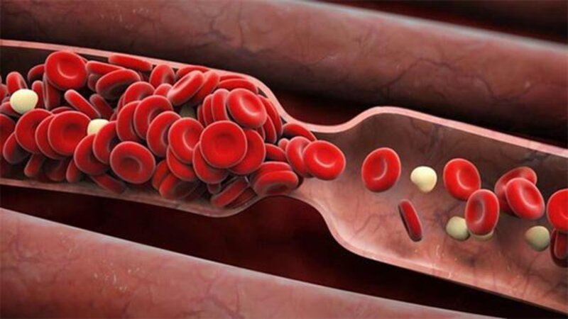 DHA hỗ trợ lưu thông máu và cải thiện chức năng nội mô cũng như khả năng giãn nở của mạch máu