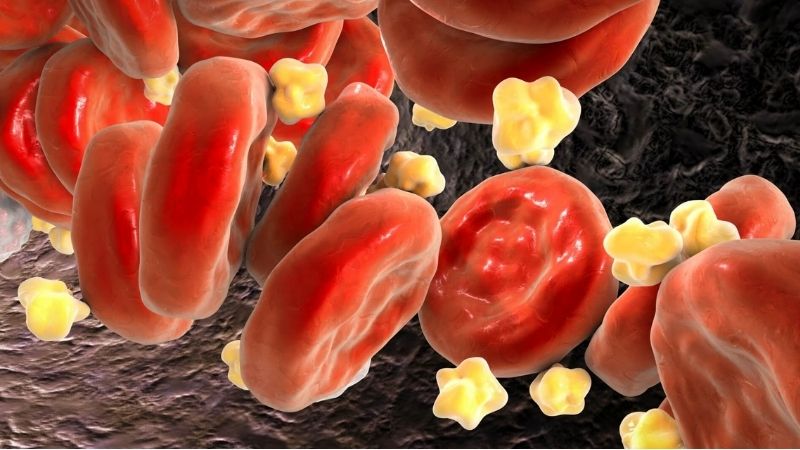 EPA làm giảm đáng kể lượng Triglyceride ở những bệnh nhân máu nhiễm mỡ