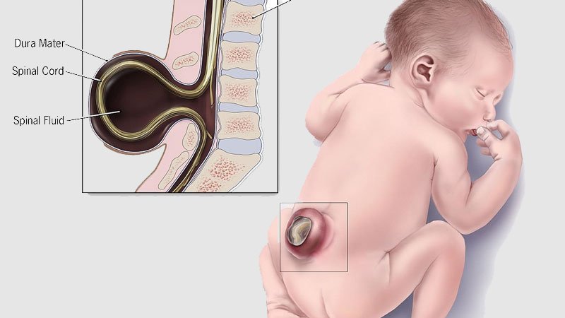 Bổ sung acid folic cho phụ nữ có thai