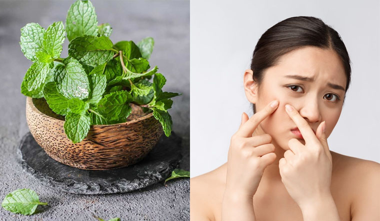 4 công thức trị mụn dễ dàng chỉ với 1 nắm lá bạc hà 