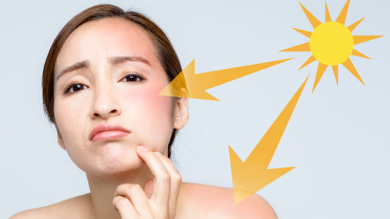 Tiếp xúc với tia cực tím lâu dài sẽ làm viêm da 
