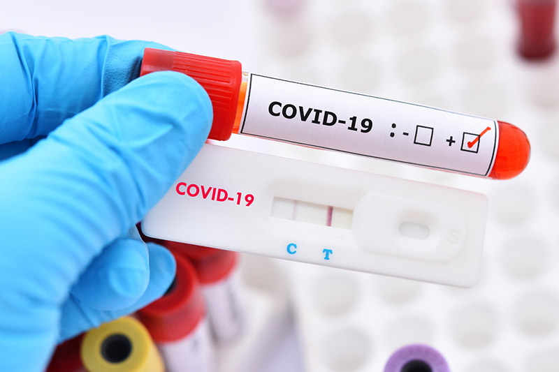 Xét nghiệm kháng thể là gì? Vì sao phải xét nghiệm kháng thể COVID-19?