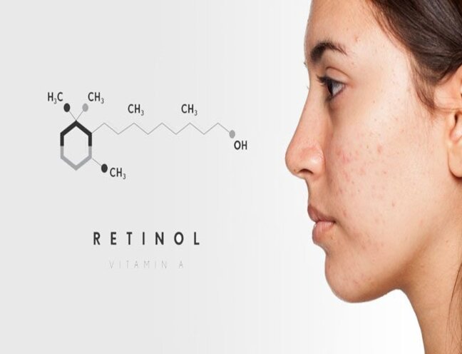 Kem trị mụn retinol có công dụng gì trực tiếp lên lysosome tế bào và giảm tổn thương như thế nào?