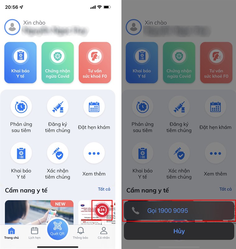 Cách sửa mũi tiêm