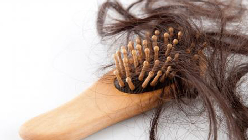 Rụng tóc là một trong những triệu chứng liên quan đến thiếu hụt vitamin D
