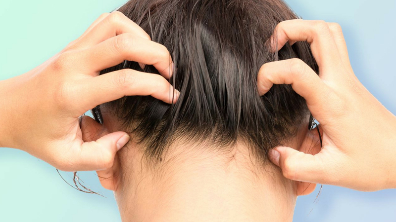 Sử dụng hóa chất được thêm vào liệu pháp chăm sóc tóc bằng Keratin có thể gây kích ứng da đầu